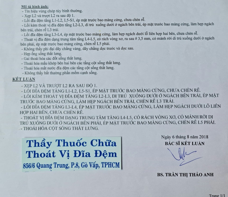 Thoát vị đĩa đệm, rách vòng xơ, chèn rễ L3 trái, chèn rễ L5 phải.